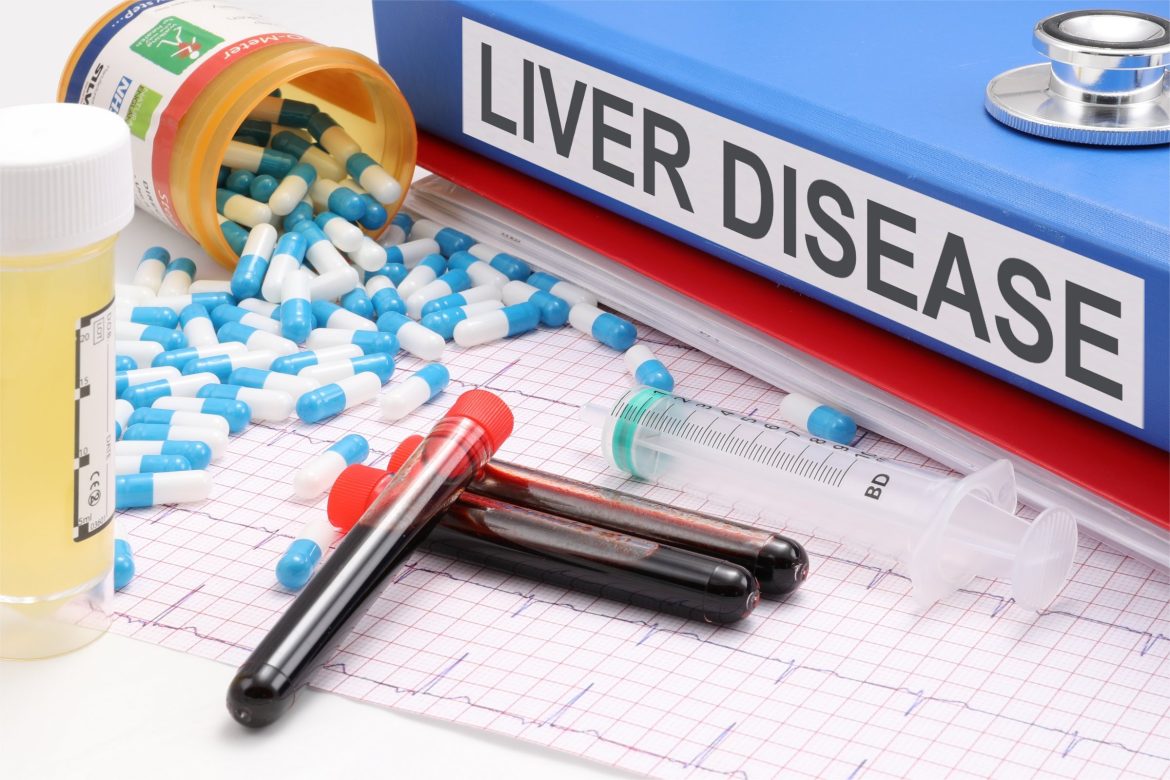 decoding-your-pets-liver-health-a-guide.jpg Decoding Your Pet’s Liver Health: A Guide