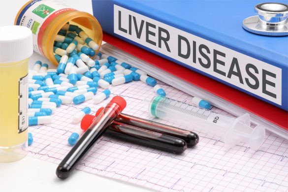 Decoding Your Pet’s Liver Health: A Guide